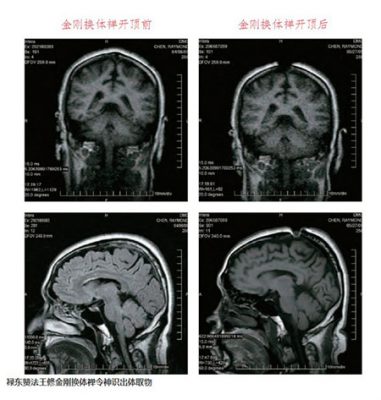 假“破瓦法”何以能在藏地流传最广?真相如何?图片 第6张 假“破瓦法”何以能在藏地流传最广?真相如何? 第6张